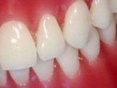 Как убрать желтый налет на зубах?