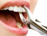 Рекомендации до и после удаления зуба