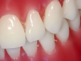 Как состояние зубов влияет на весь организм?