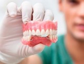 Имплантация зубов в Киеве: пошаговая инструкция